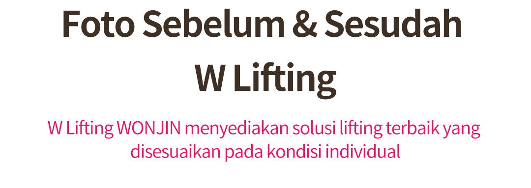 Foto Sebelum & Sesudah  W Lifting W Lifting WONJIN menyediakan solusi lifting terbaik yang  dises