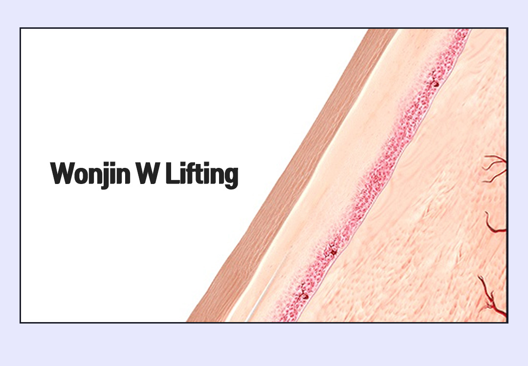 Wonjin W Lifting