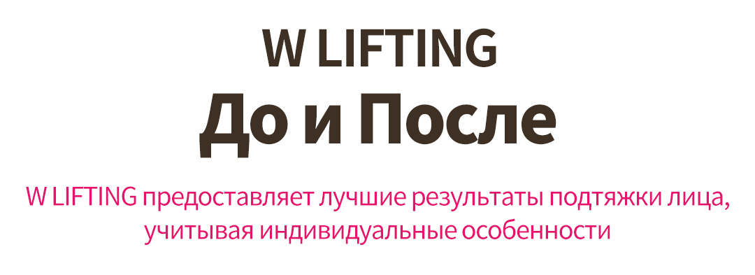 W LIFTING До и После , W LIFTING предоставляет лучшие результаты подтяжки лица, учитывая индивидуальные особенности