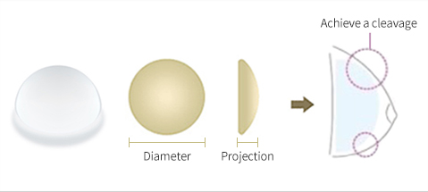 Characteristics of Round Implant