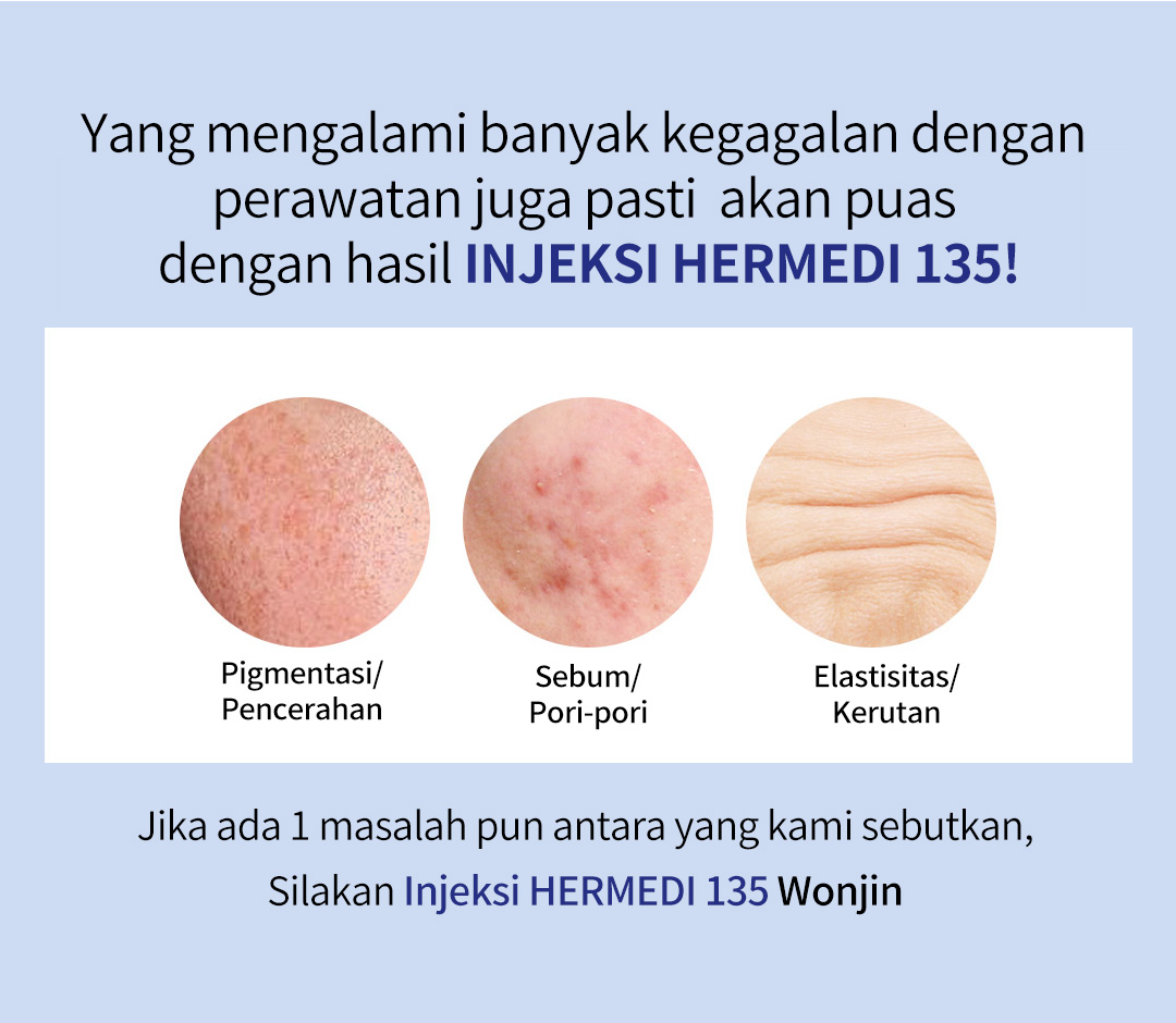 Sejak kecil, saya sangat stress dengan bekas jerawat. Sekarang bekas jerawat dan pori-pori jauh lebih berkurang setelah 2 kali perawatan HERMEDI 135. Saya sangat menunggu hasilnya setelah perawatan kali ke-3.,Karena kulitku tipis, bintik-bintik sering muncul dan jerawat pun sering muncul. Setelah perawatan suntikan Hermedi 135, kulitku sepertinya kencang dan tebal. Bahkan mukaku berkilap dan cerah juga. Akhir-akhir ini aku tidak make-up