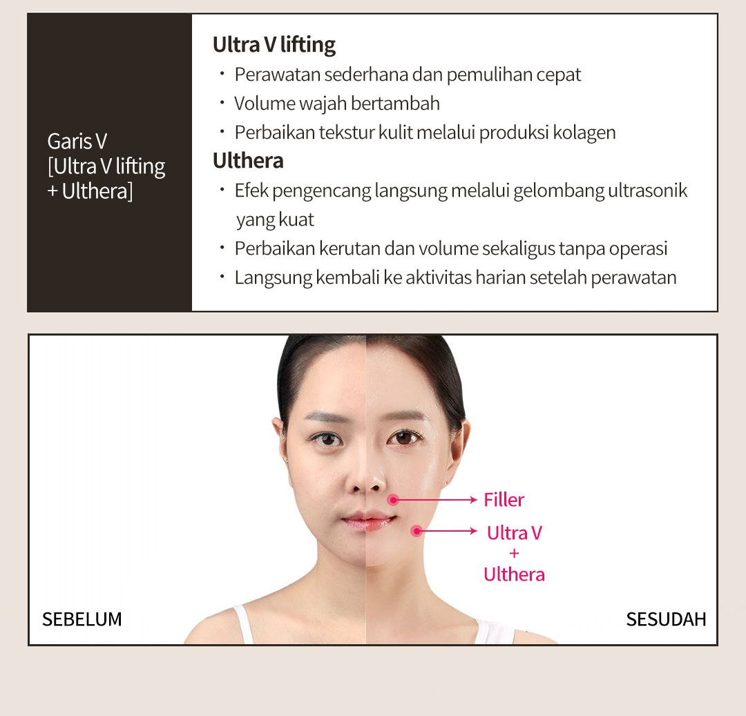 Garis V [Ultra V lifting + Ulthera] Ultra V liftingㆍ Perawatan sederhana dan pemulihan cepatㆍ Volume wajah bertambahㆍ Perbaikan tekstur kulit melalui produksi kolagenUltheraㆍ Efek pengencang langsung melalui gelombang ultrasonik 
       yang kuatㆍ Perbaikan kerutan dan volume sekaligus tanpa operasiㆍ Langsung kembali ke aktivitas harian setelah perawatan