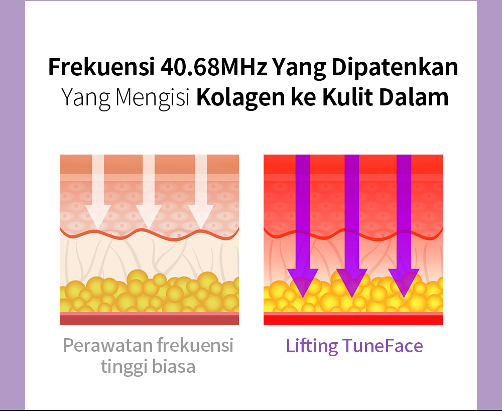 Frekuensi 40.68MHz Yang DipatenkanYang Mengisi Kolagen ke Kulit Dalam , Perawatan frekuensi tinggi biasa /Lifting TuneFace 