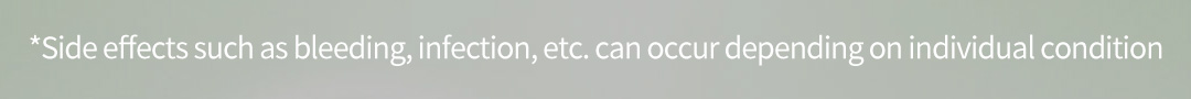 *Side effects such as bleeding, infection, etc. can occur depending on individual condition 