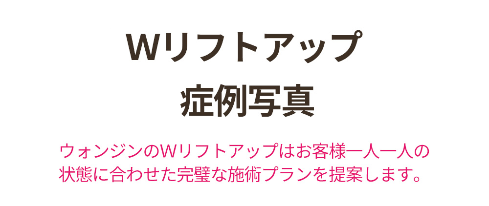 Ｗリフトアップ症例写真 , ウォンジンのＷリフトアップはお客様一人一人の状態に合わせた完璧な施術プランを提案します。