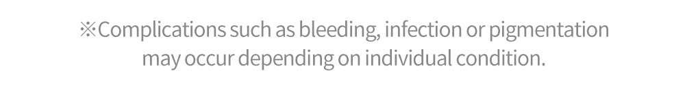 ※Complications such as bleeding, infection or pigmentation may occur depending on individual condition.