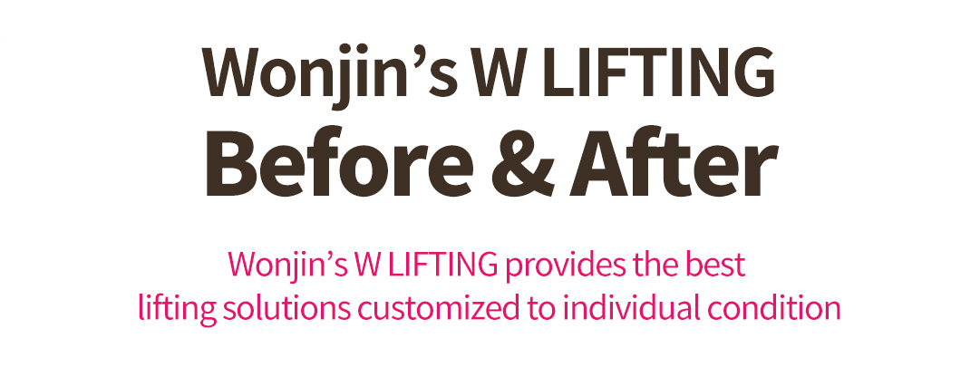 Wonjin’s W LIFTING Before & After, Wonjin’s W LIFTING provides the best lifting solutions customized to individual condition