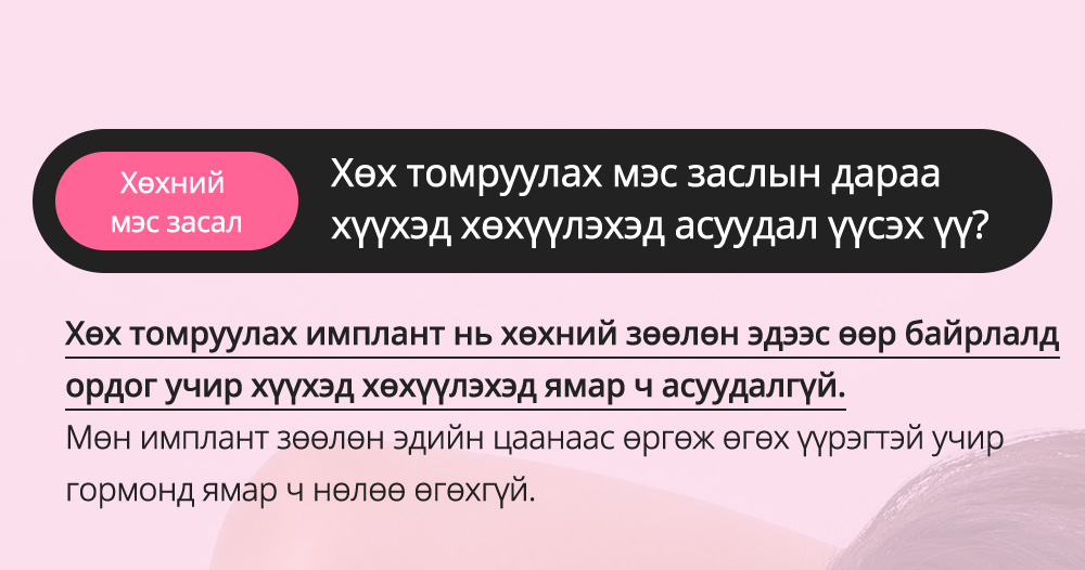 Хөхний мэс засал Хөх томруулах мэс заслын дараа хүүхэд хөхүүлэхэд асуудал үүсэх үү? Хөх томруулах имплант нь хөхний зөөлөн эдээс өөр байрлалд ордог учир хүүхэд хөхүүлэхэд ямар ч асуудалгүй.Мөн имплант зөөлөн эдийн цаанаас өргөж өгөх үүрэгтэй учир гормонд ямар ч нөлөө өгөхгүй. -