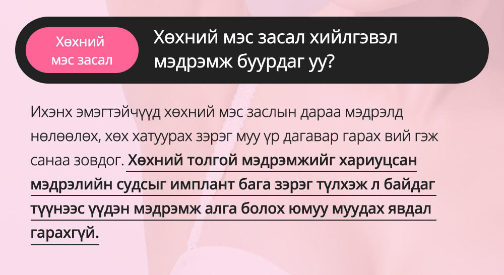 Хөхний мэс засал - Хөхний мэс засал хийлгэвэл мэдрэмж буурдаг уу? Ихэнх эмэгтэйчүүд хөхний мэс заслын дараа мэдрэлд нөлөөлөх, хөх хатуурах зэрэг муу үр дагавар гарах вий гэж санаа зовдог. Хөхний толгой мэдрэмжийг хариуцсан мэдрэлийн судсыг имплант бага зэрэг түлхэж л байдаг түүнээс үүдэн мэдрэмж алга болох юмуу муудах явдал гарахгүй. 