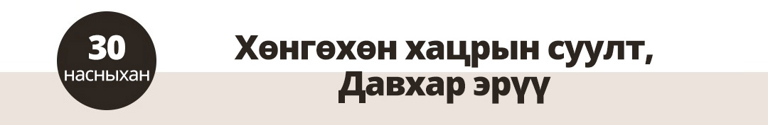 30 насныхан Хөнгөхөн хацрын суулт, Давхар эрүү