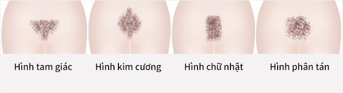 Hình tam giác ngược,Diamond shape,Hình chữ nhật,Hình dạng phân tán