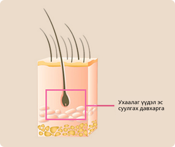 Ухаалаг үүдэл эс суулгах давхарга