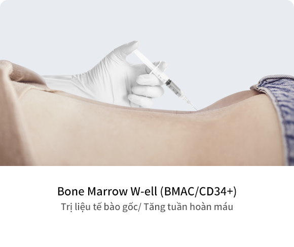 Bone Marrow W-ell (BMAC/CD34+) Trị liệu tế bào gốc/ Tăng tuần hoàn máu