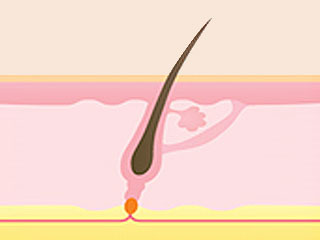 幹細胞毛髪移植の原理1