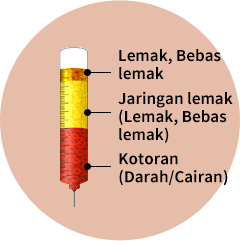 Dipisahkan kemudian disuntikkan setelah mengurangi kerusakan panas dan paparan udara dengan menggunakan alat lipokit