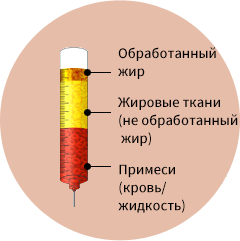 Отделяют, атем вводят после уменьшения теплового повреждения и контакта с воздухом с помощью устройства Lipokit