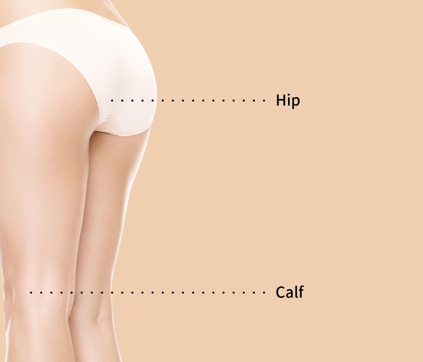 Areas for Non-invasive lifting