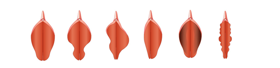 Various types of Labia Minora