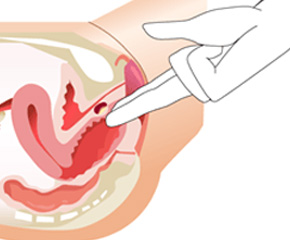 Ideal Labia Minora