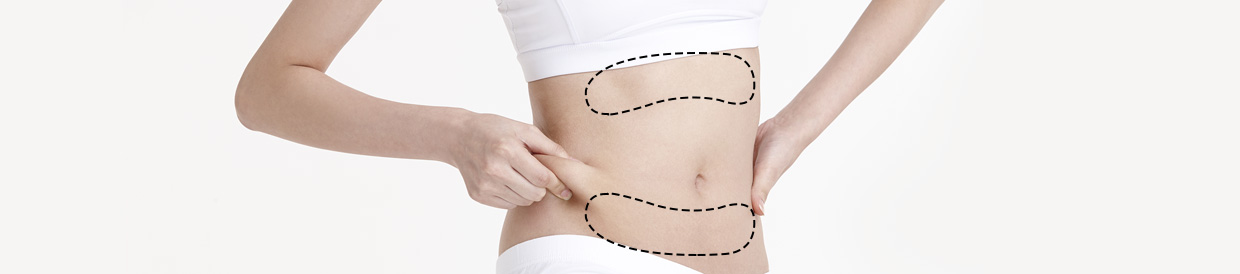 Abdomen Liposuction