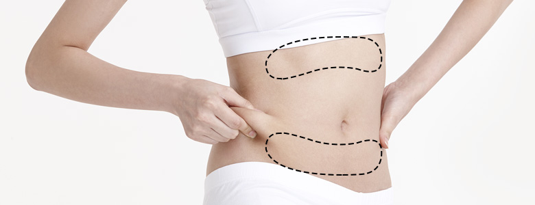 Abdomen Liposuction