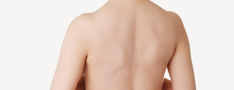 Back Liposuction