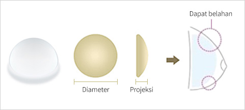 Pembesaran Implan Jenis Round