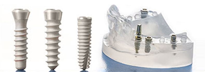 Dental Implant