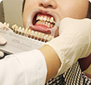 Проверка цвета зубов