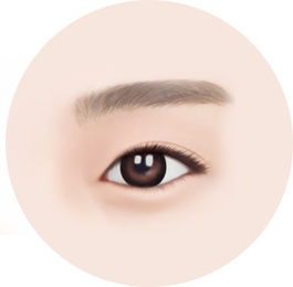 Double Eyelid Surgery+Epicanthoplasty