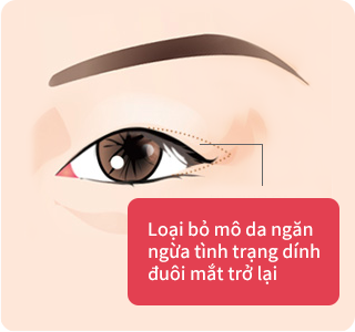 Loại bỏ các mô dẫn đến tình trạng da bị dính lại