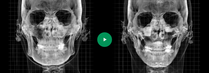 CT01 Before & After