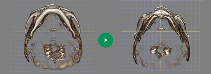 CT02 Before & After