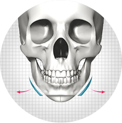 V-line facial contouring