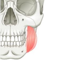 Muscle Resection