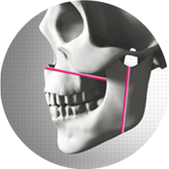 Two Jaw Surgery