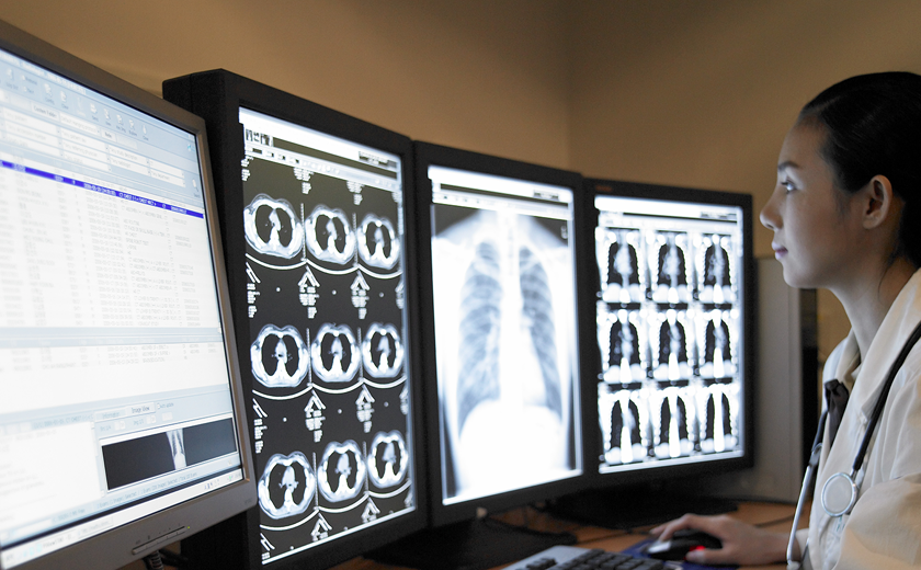 3D CT Neurocranium Công suất cao