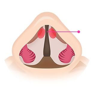 Septal cartilage