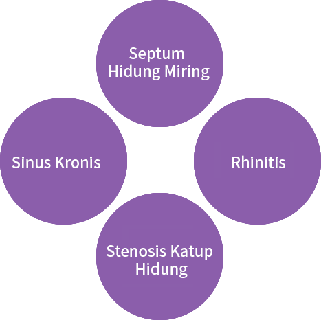 Operasi Hidung Tersumbat (Fungsional)