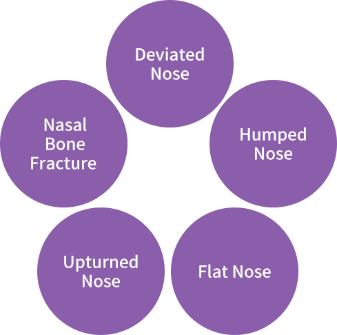 Rhinoplasty (Cosmetic)