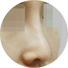 Đầu mũi thấp