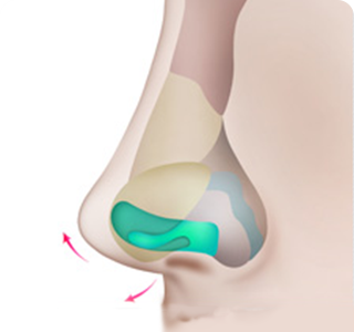 Arrowed Nasal Tip Step 02