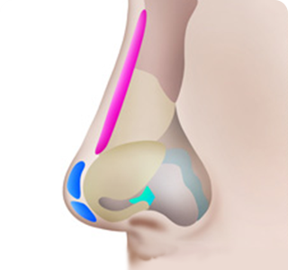 Arrowed Nasal Tip Step 04