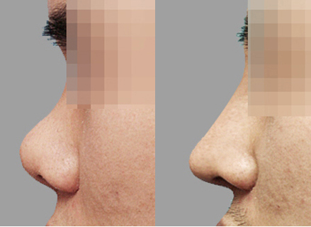 Before & After