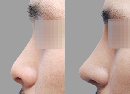 Before & After