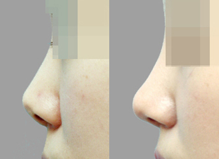 Before & After