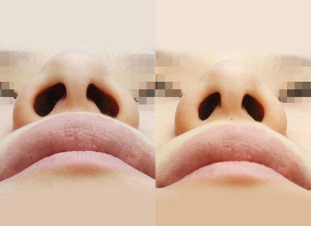 Before & After