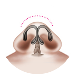 Types of Blunt Nose