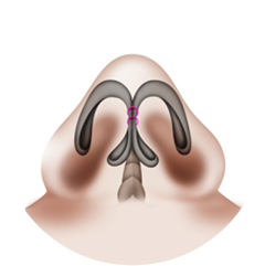 Nasal Tip In Ideal Shape