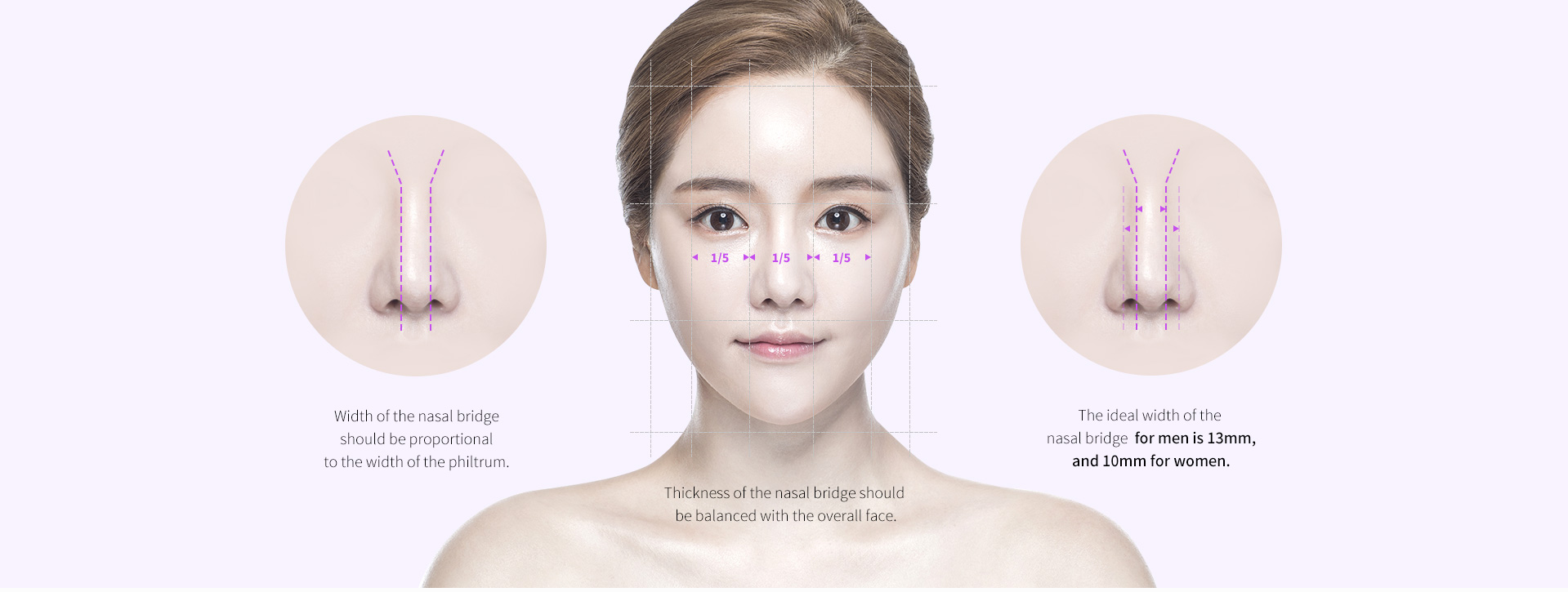 Surgical points of Wide Nasal Bridge Surgery